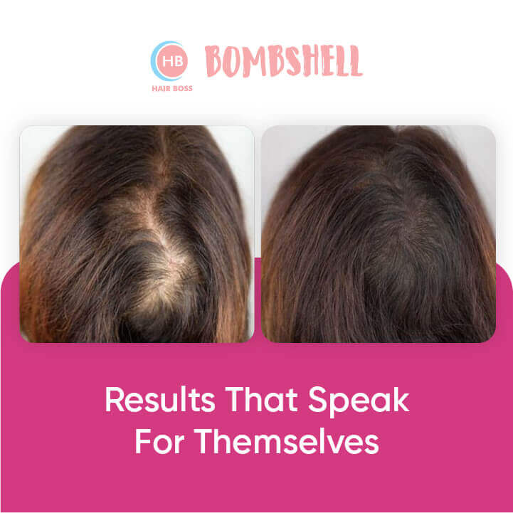 Bombshell Hair Growth Spray: For Men & Women.